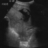 ultrasound3