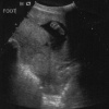 ultrasound4