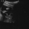 ultrasound5